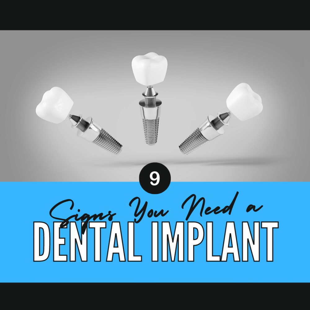 9 Signs You Need a Dental Implant