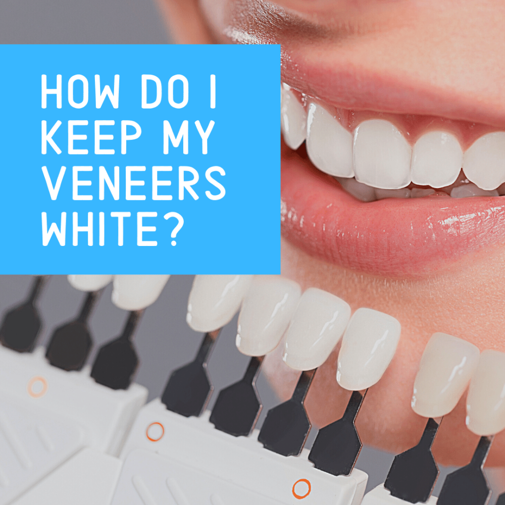 How Do I Keep my Veneers White?