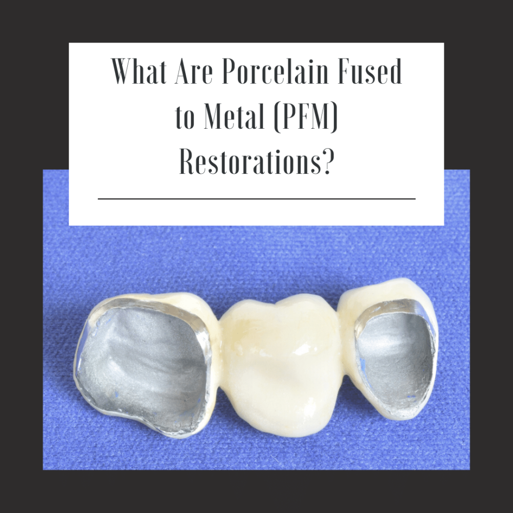What are Porcelain Fused to Metal (PFM) Restorations?